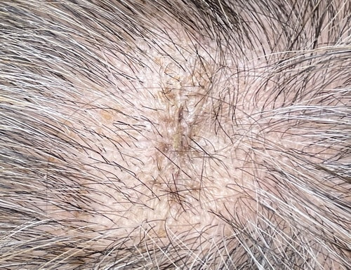 術後の経過写真