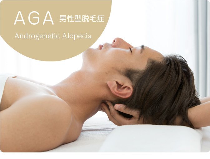 AGA男性型脱毛症