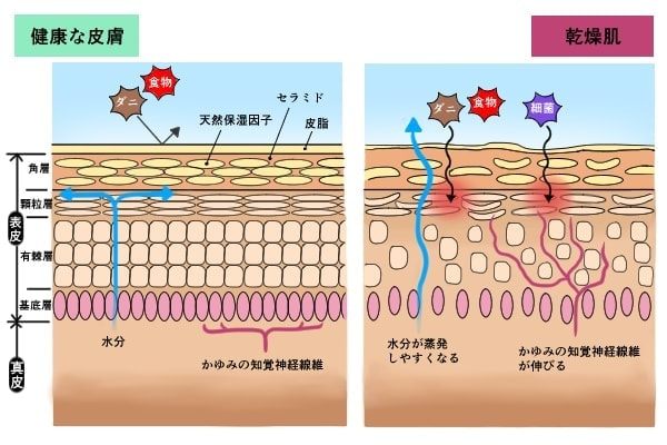 乾燥肌