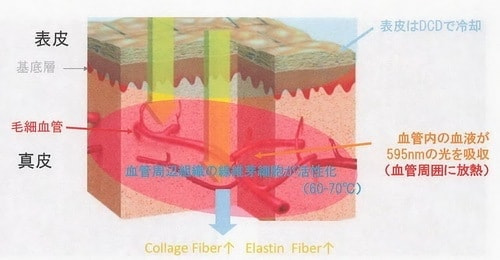 Vbeamの肌質改善のメカニズム