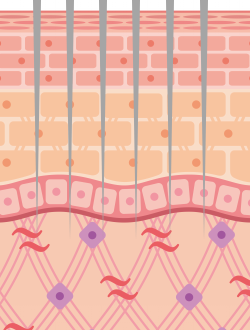 ダーマペンとフラクショナル治療の比較