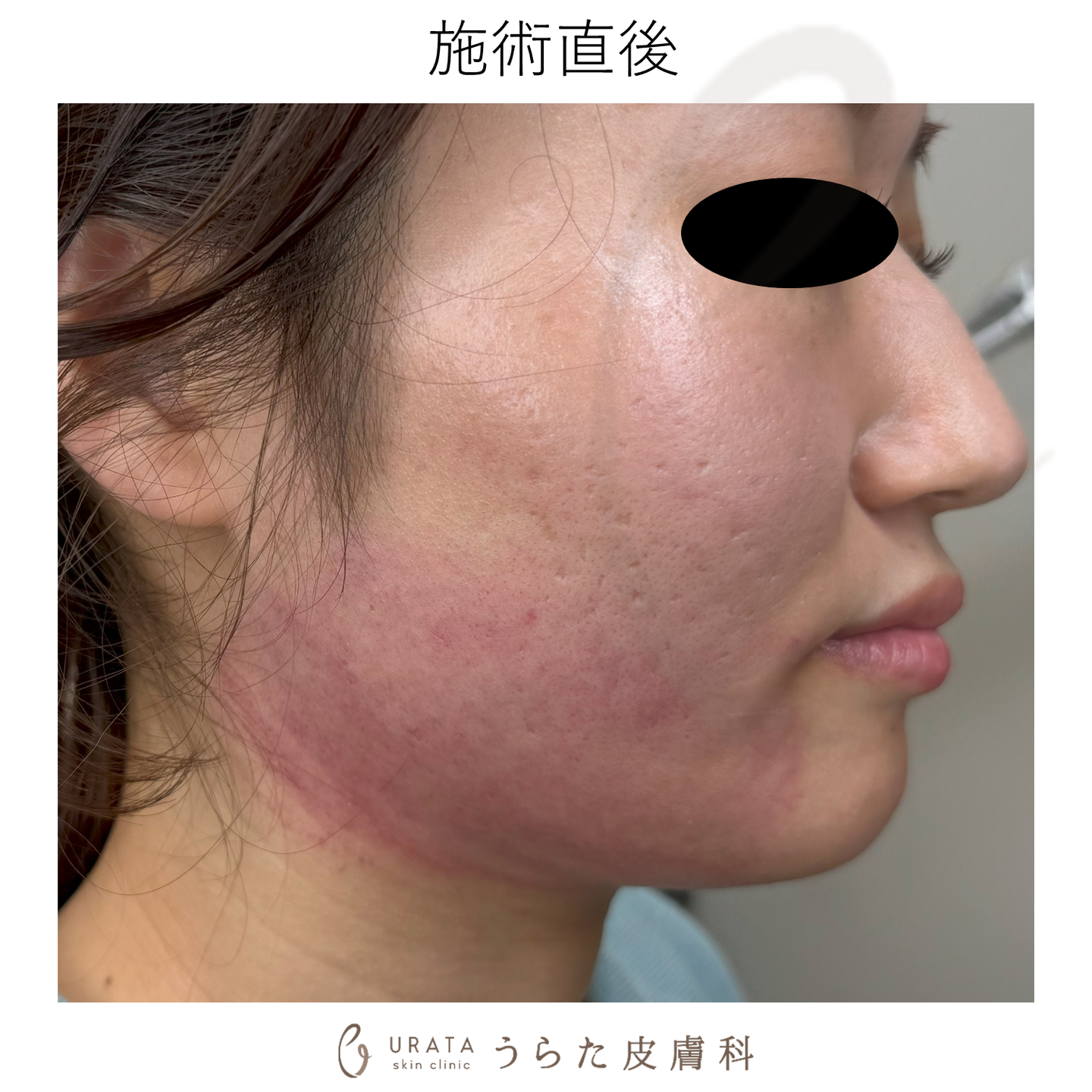 MINI FXのダウンタイム