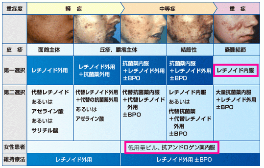 海外のニキビ治療